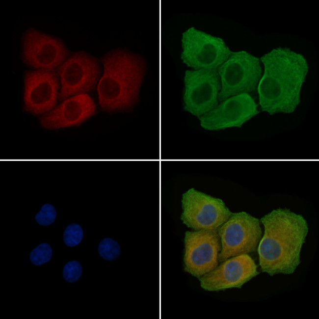 Phospho-VEGF Receptor 1 (Tyr1048) Antibody in Immunocytochemistry (ICC/IF)