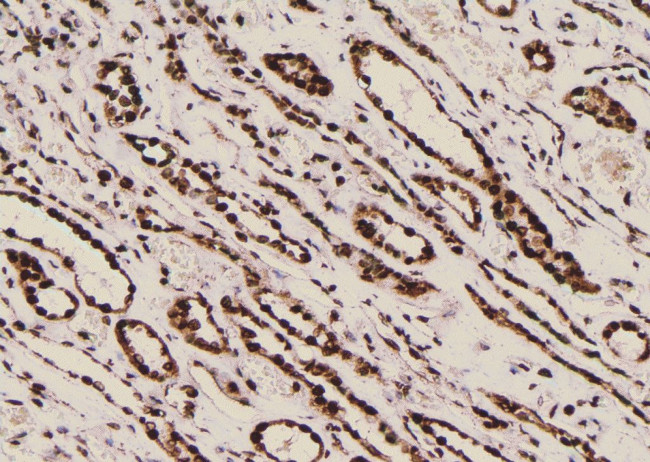 Phospho-Filamin A (Tyr1604) Antibody in Immunohistochemistry (Paraffin) (IHC (P))