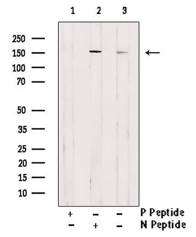 Phospho-ErbB3 (Tyr1222) Antibody in Western Blot (WB)