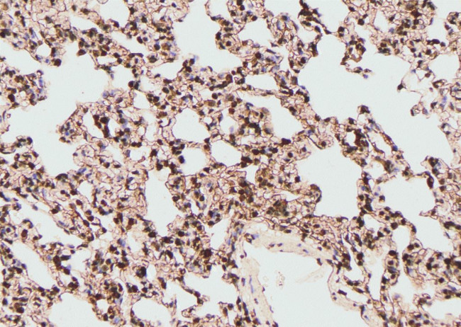 Phospho-FGFR4 (Tyr642) Antibody in Immunohistochemistry (Paraffin) (IHC (P))