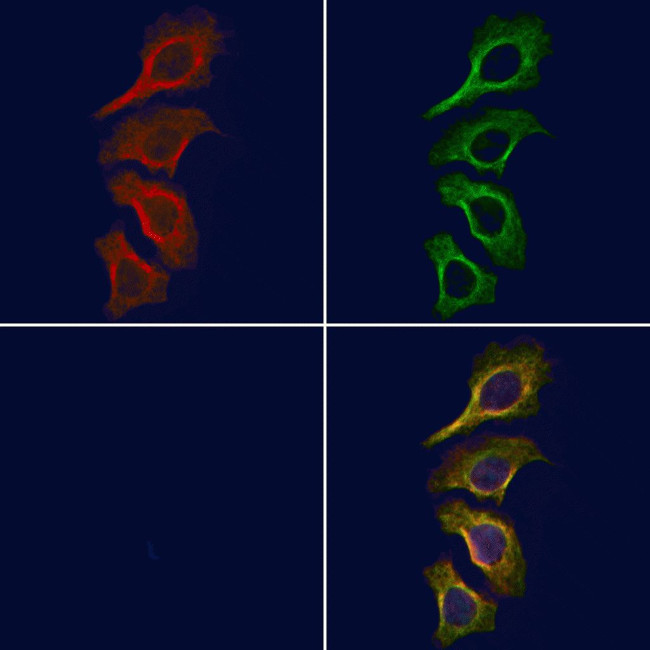 Phospho-JAK1 (Tyr1125) Antibody in Immunocytochemistry (ICC/IF)