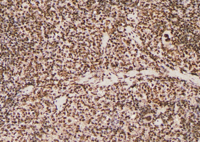 Phospho-JAK1 (Tyr1125) Antibody in Immunohistochemistry (Paraffin) (IHC (P))