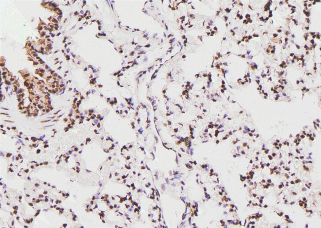 Phospho-EIF4B (Ser497) Antibody in Immunohistochemistry (Paraffin) (IHC (P))