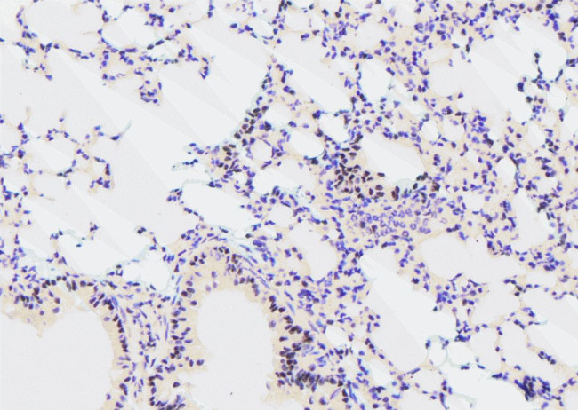 Phospho-GATA2 (Ser192) Antibody in Immunohistochemistry (Paraffin) (IHC (P))