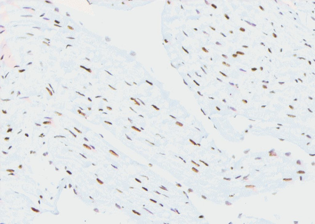 Phospho-RNA pol II CTD (Ser2, Ser5) Antibody in Immunohistochemistry (Paraffin) (IHC (P))