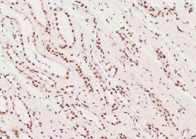 Phospho-RNA pol II CTD (Tyr145) Antibody in Immunohistochemistry (Paraffin) (IHC (P))