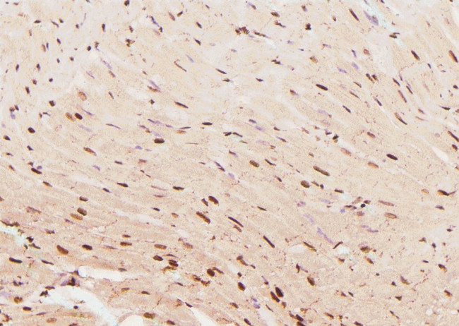 Phospho-RNA pol II CTD (Tyr145) Antibody in Immunohistochemistry (Paraffin) (IHC (P))