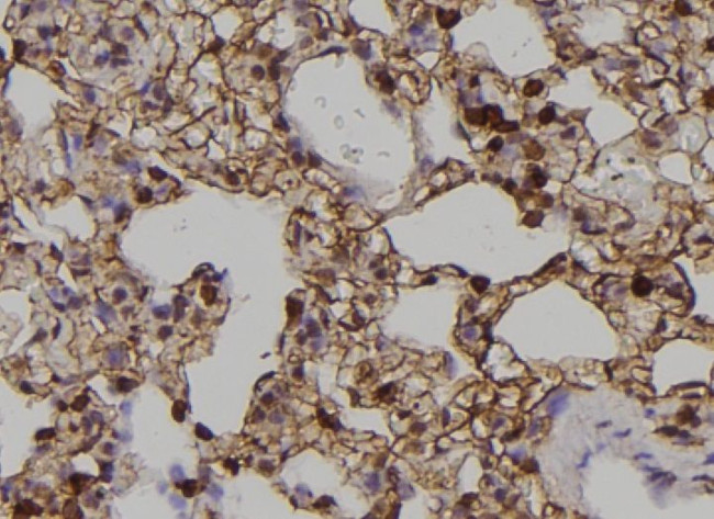 Phospho-EphA2 (Tyr588) Antibody in Immunohistochemistry (Paraffin) (IHC (P))