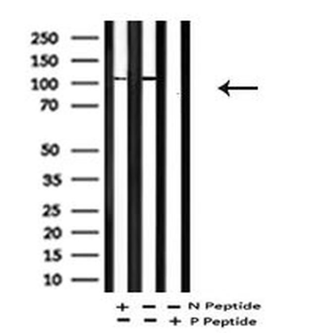 Phospho-EphA2 (Tyr588) Antibody in Western Blot (WB)