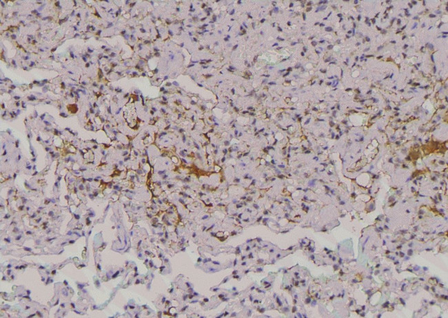 Phospho-EphA2 (Thr587) Antibody in Immunohistochemistry (Paraffin) (IHC (P))