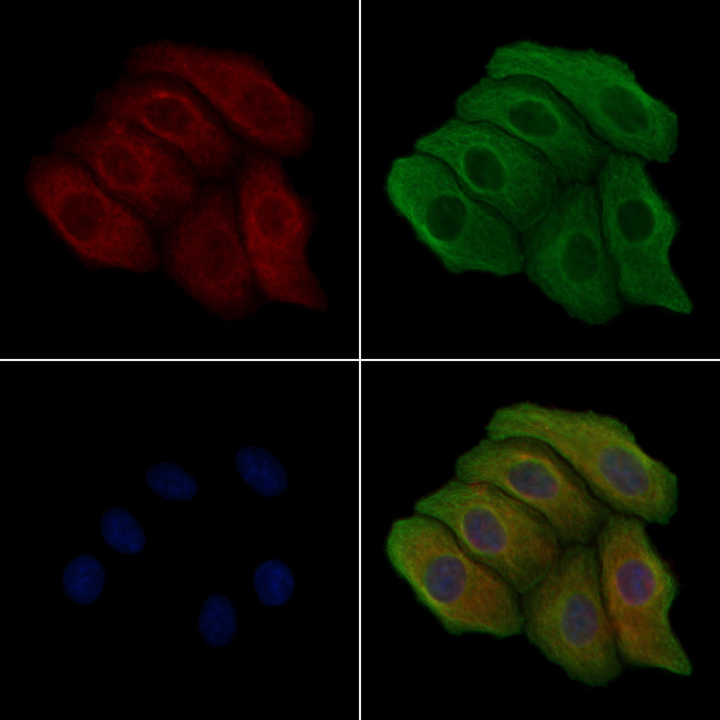 Phospho-EphA2 (Ser901) Antibody in Immunocytochemistry (ICC/IF)