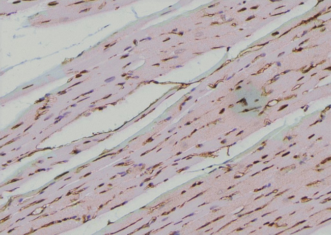 Phospho-EphA2 (Ser901) Antibody in Immunohistochemistry (Paraffin) (IHC (P))