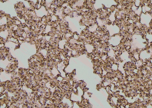 Phospho-EphA2 (Ser901) Antibody in Immunohistochemistry (Paraffin) (IHC (P))