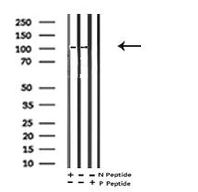 Phospho-EphA2 (Ser901) Antibody in Western Blot (WB)