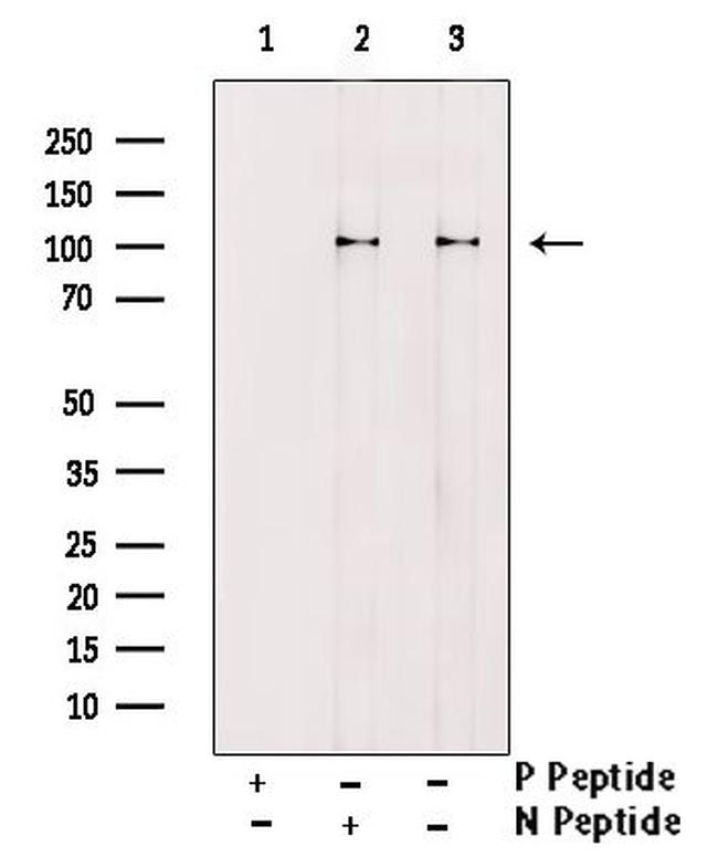 Phospho-EphA2 (Ser901) Antibody in Western Blot (WB)