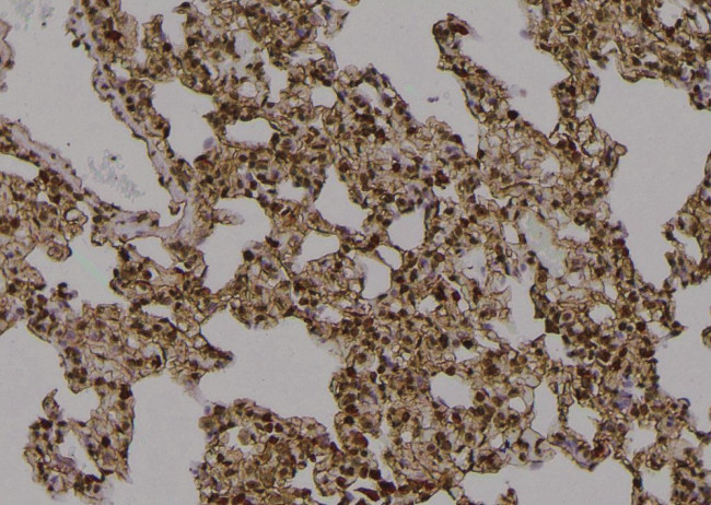 Phospho-EphA3 (Tyr596) Antibody in Immunohistochemistry (Paraffin) (IHC (P))