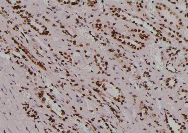 Phospho-TYK2 (Tyr433) Antibody in Immunohistochemistry (Paraffin) (IHC (P))