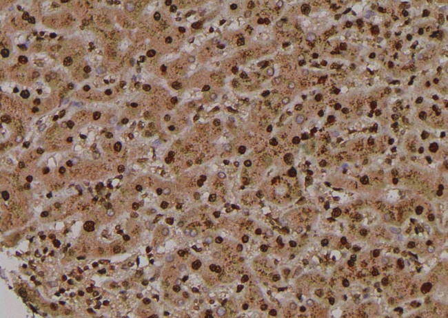 Phospho-TYK2 (Tyr433) Antibody in Immunohistochemistry (Paraffin) (IHC (P))