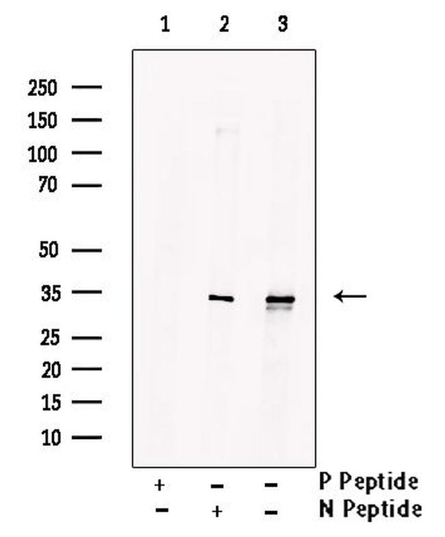 Phospho-MARCKS (Ser27) Antibody in Western Blot (WB)