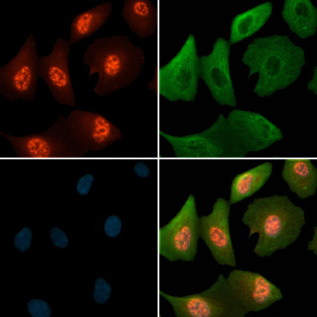 Phospho-MCM4 (Ser88) Antibody in Immunocytochemistry (ICC/IF)