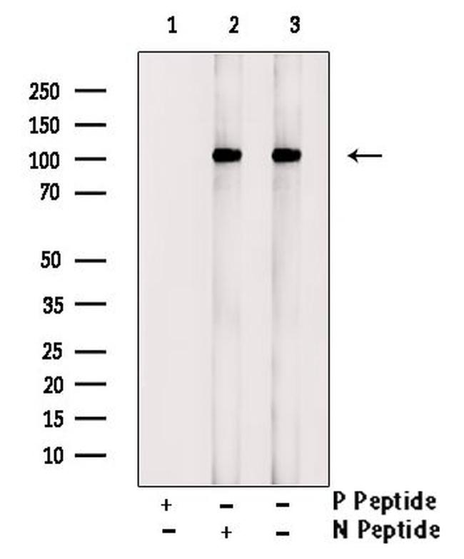 Phospho-Catenin alpha-1 (Tyr177) Antibody in Western Blot (WB)