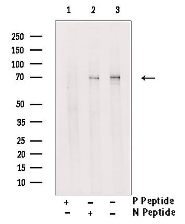 Phospho-NF2 (Ser13) Antibody in Western Blot (WB)