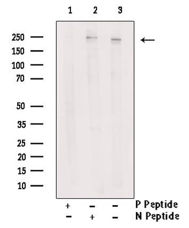 Phospho-MYH9 (Tyr754) Antibody in Western Blot (WB)
