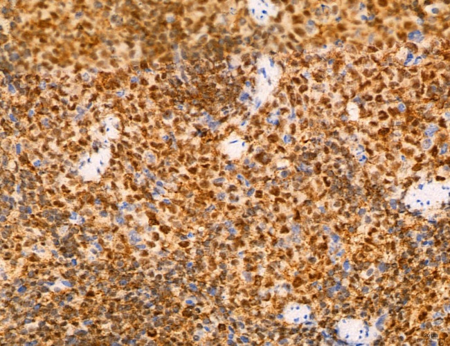 Phospho-FLT3 (Tyr631) Antibody in Immunohistochemistry (Paraffin) (IHC (P))