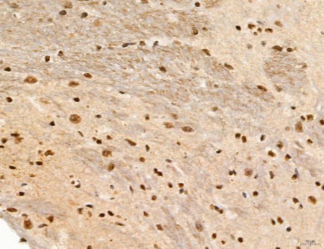 Phospho-FLT3 (Tyr631) Antibody in Immunohistochemistry (Paraffin) (IHC (P))