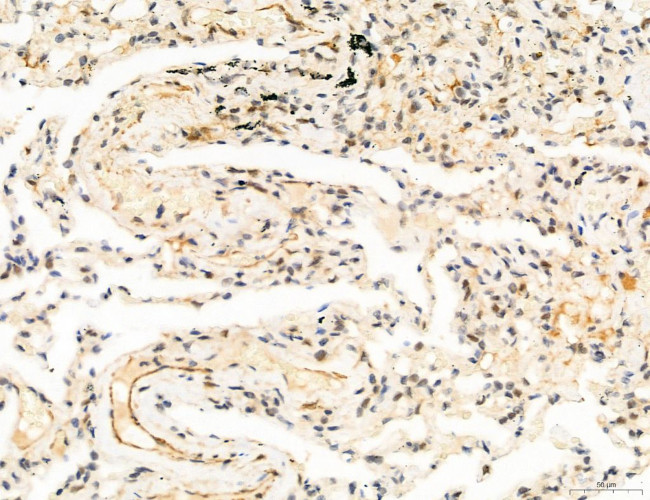 Phospho-FLT3 (Tyr631) Antibody in Immunohistochemistry (Paraffin) (IHC (P))