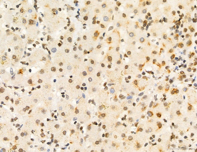 Phospho-FLT3 (Tyr631) Antibody in Immunohistochemistry (Paraffin) (IHC (P))