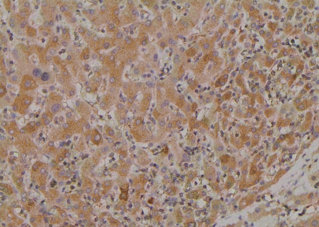 Phospho-SREBP1 (Ser338) Antibody in Immunohistochemistry (Paraffin) (IHC (P))