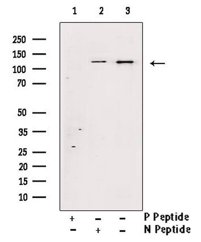 Phospho-SREBP1 (Ser338) Antibody in Western Blot (WB)