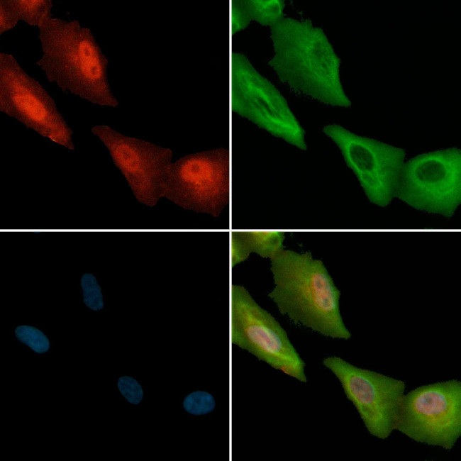 Phospho-SREBP1 (Ser338) Antibody in Immunocytochemistry (ICC/IF)