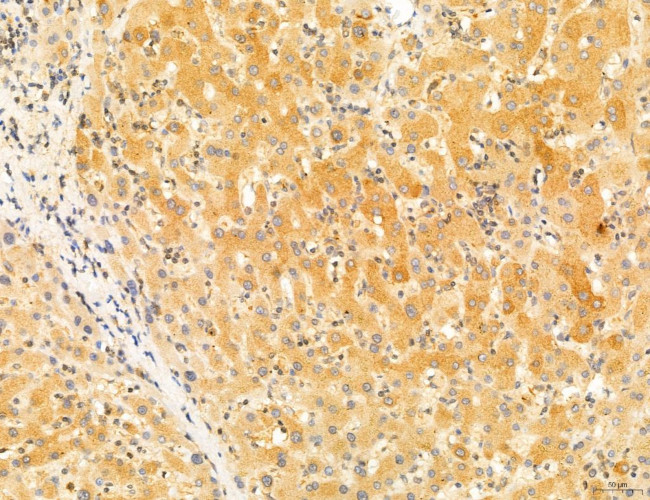 Phospho-SREBP1 (Ser338) Antibody in Immunohistochemistry (Paraffin) (IHC (P))