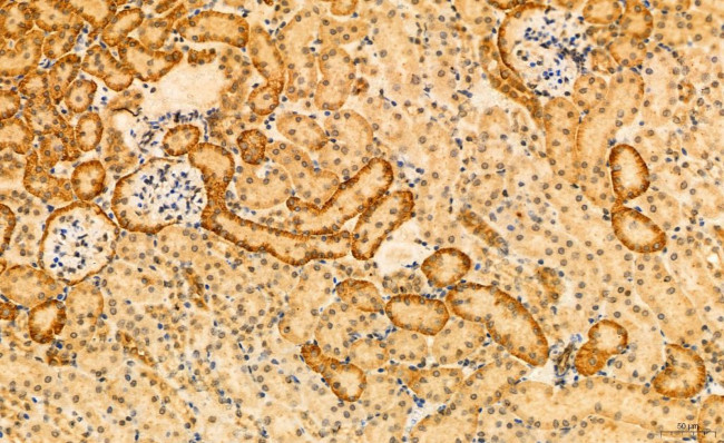 Phospho-SREBP1 (Ser338) Antibody in Immunohistochemistry (Paraffin) (IHC (P))