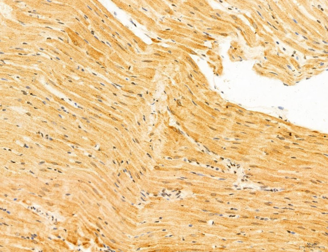 Phospho-SREBP1 (Ser338) Antibody in Immunohistochemistry (Paraffin) (IHC (P))