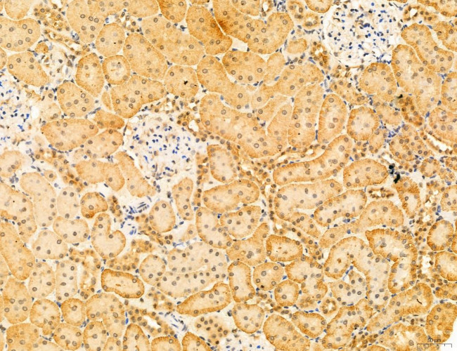 Phospho-SREBP1 (Ser338) Antibody in Immunohistochemistry (Paraffin) (IHC (P))