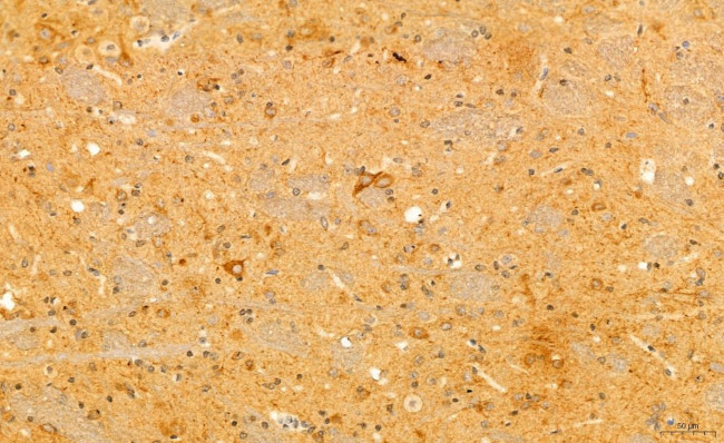 Phospho-SREBP1 (Ser338) Antibody in Immunohistochemistry (Paraffin) (IHC (P))