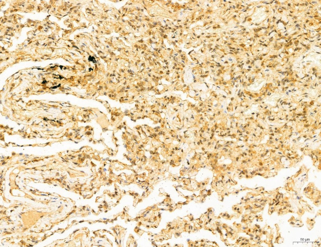 Phospho-SREBP1 (Ser338) Antibody in Immunohistochemistry (Paraffin) (IHC (P))