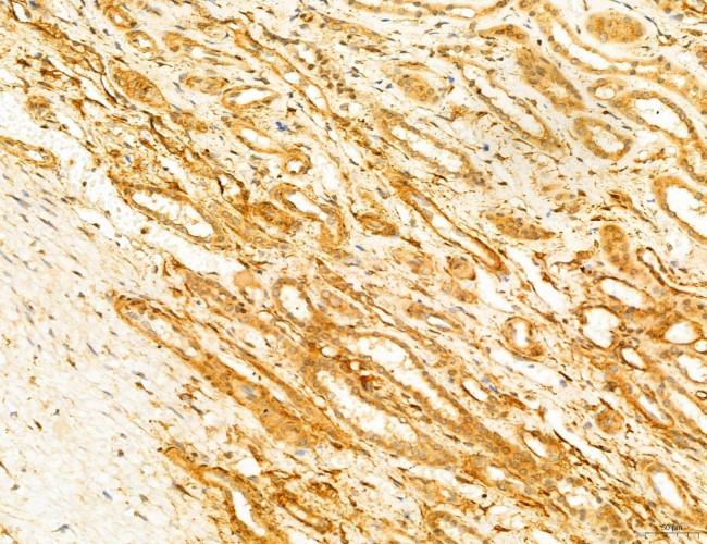 Phospho-SREBP1 (Ser338) Antibody in Immunohistochemistry (Paraffin) (IHC (P))