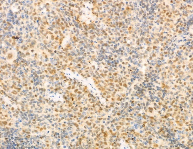 Phospho-GluR1 (Ser836) Antibody in Immunohistochemistry (Paraffin) (IHC (P))