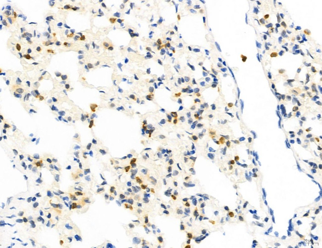 Phospho-GluR1 (Ser836) Antibody in Immunohistochemistry (Paraffin) (IHC (P))