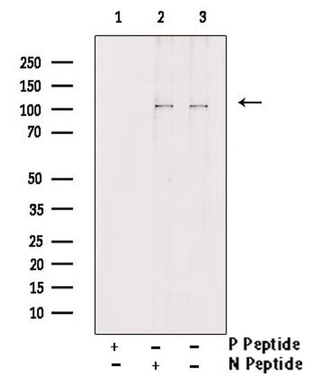 Phospho-GluR1 (Ser836) Antibody in Western Blot (WB)