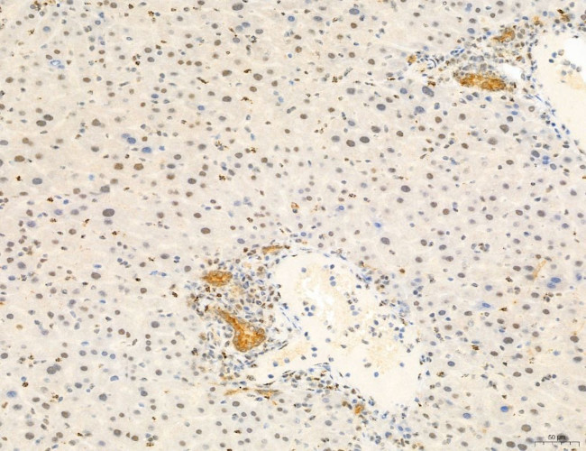 Phospho-mTOR (Ser2454) Antibody in Immunohistochemistry (Paraffin) (IHC (P))