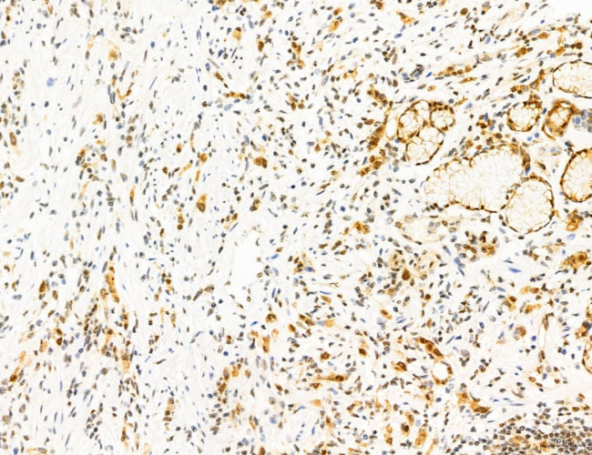 Phospho-mTOR (Ser2454) Antibody in Immunohistochemistry (Paraffin) (IHC (P))