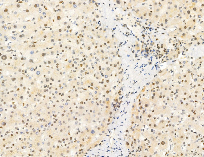 Phospho-mTOR (Ser2454) Antibody in Immunohistochemistry (Paraffin) (IHC (P))