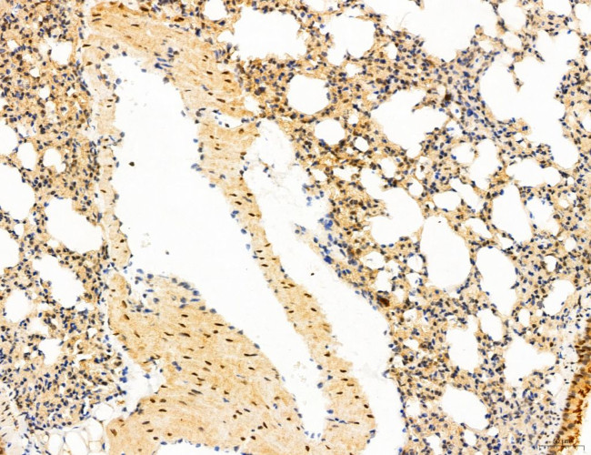 Phospho-mTOR (Ser2454) Antibody in Immunohistochemistry (Paraffin) (IHC (P))