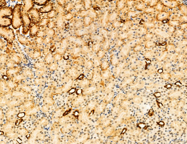 Phospho-mTOR (Ser2454) Antibody in Immunohistochemistry (Paraffin) (IHC (P))