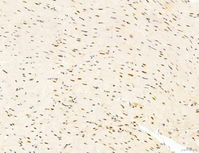 Phospho-mTOR (Ser2454) Antibody in Immunohistochemistry (Paraffin) (IHC (P))